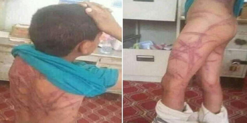 الأمن يتفاعل مع قضية تعذيب طفل بكرسيف