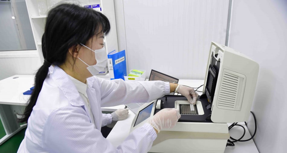 Covid-19: des scientifiques révèlent des lésions cérébrales à long terme