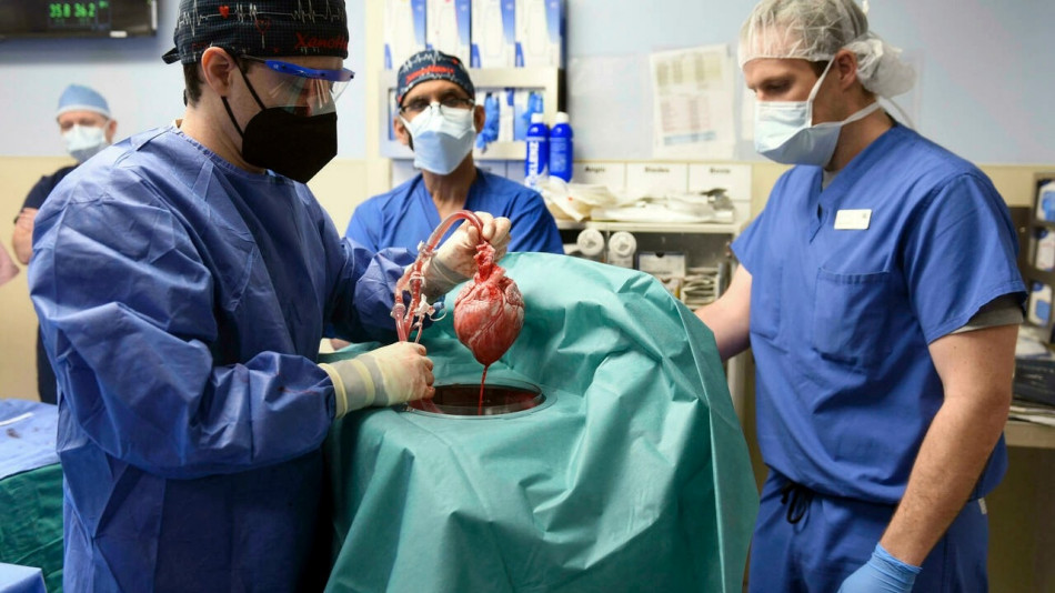 جراحون ينجحون في زرع قلب خنزير داخل جسم إنسان