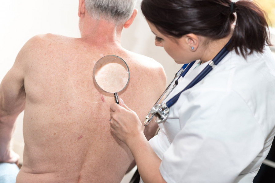 Moderna et Merck annoncent de premiers résultats positifs pour un vaccin contre le cancer de la peau