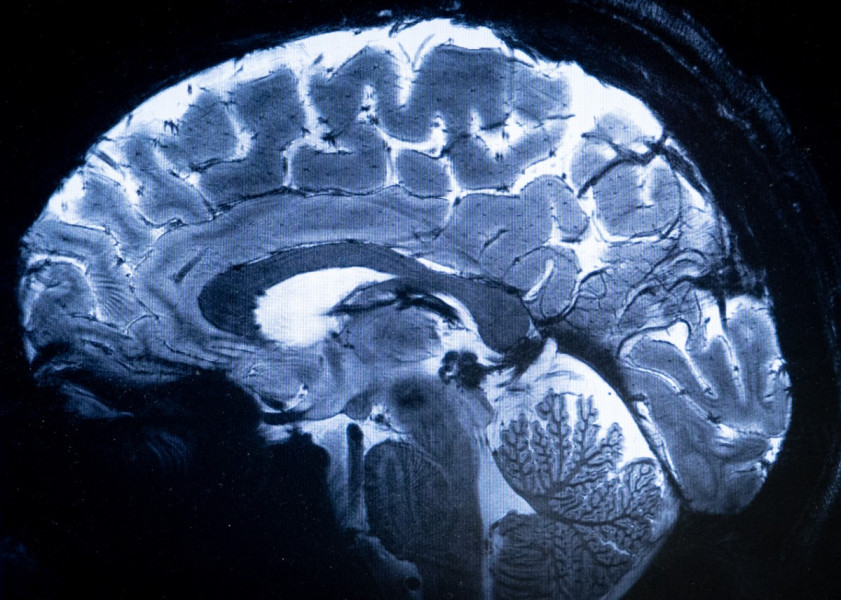 CERVEAU