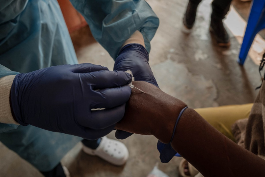 Mpox en Afrique: 53.903 cas enregistrés