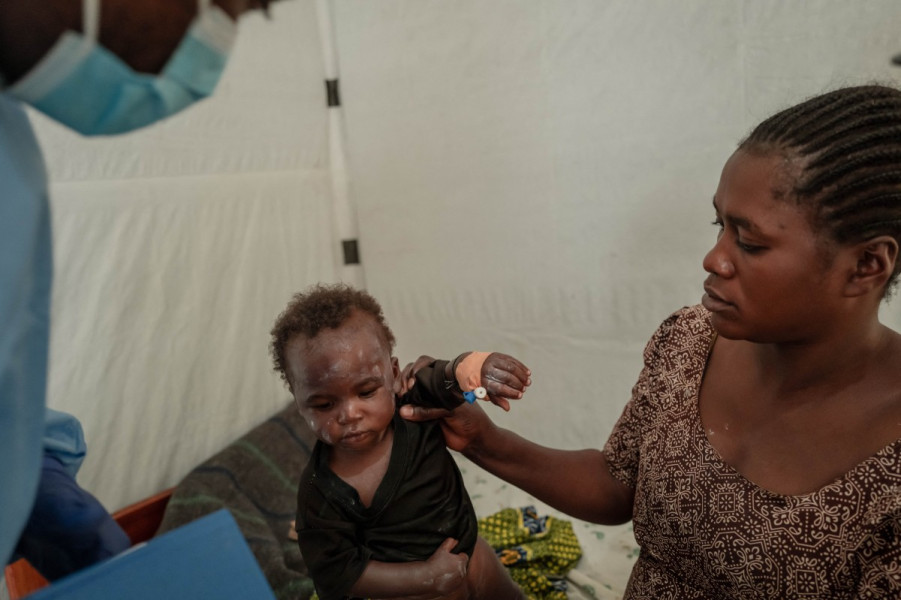 Mpox/UA: Le bilan de 26.544 cas alerte autant qu’il inquiète