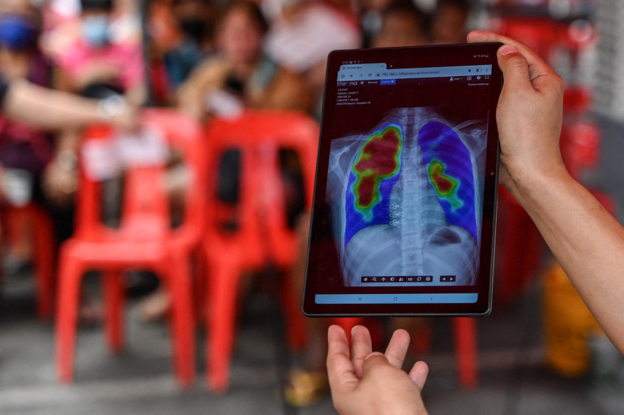 Journée mondiale de la tuberculose: mobilisation pour mettre fin à la maladie
