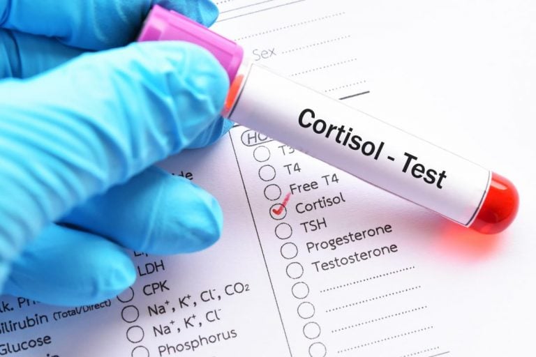 cortisol الكورتيزول