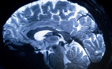 CERVEAU