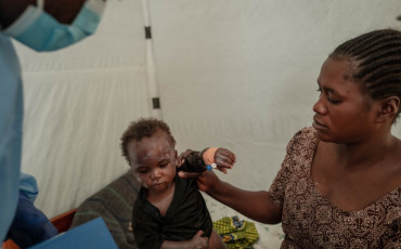 Mpox