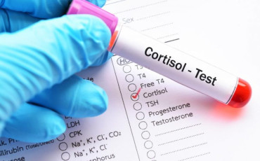 cortisol الكورتيزول
