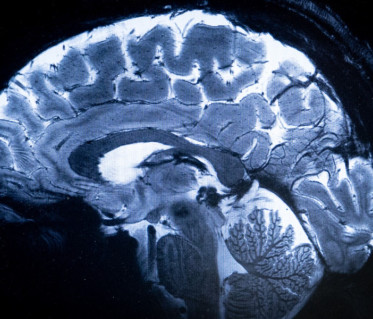 CERVEAU