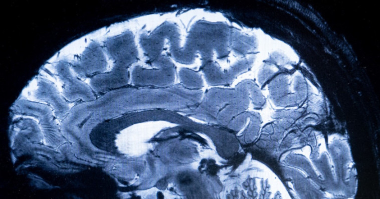 CERVEAU