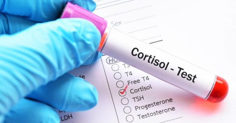 cortisol الكورتيزول